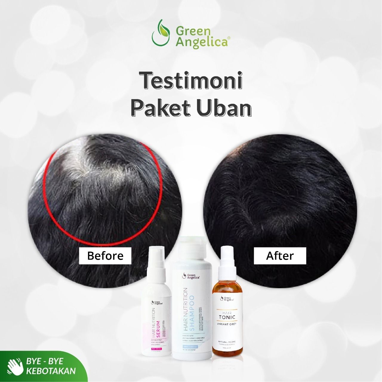 Serum dari Mutasi Mikro Pigmen Rambut Tertua: Revolusi dalam Perawatan Rambut dan Rahasia Awet Muda